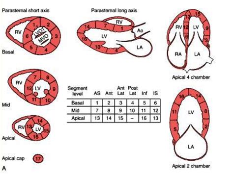 lv segment echo|how to assess lv function.